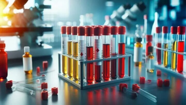 شرکت پالایش و پژوهش خون ایران وارد عرصه تولید آلبومین و IVIG شد