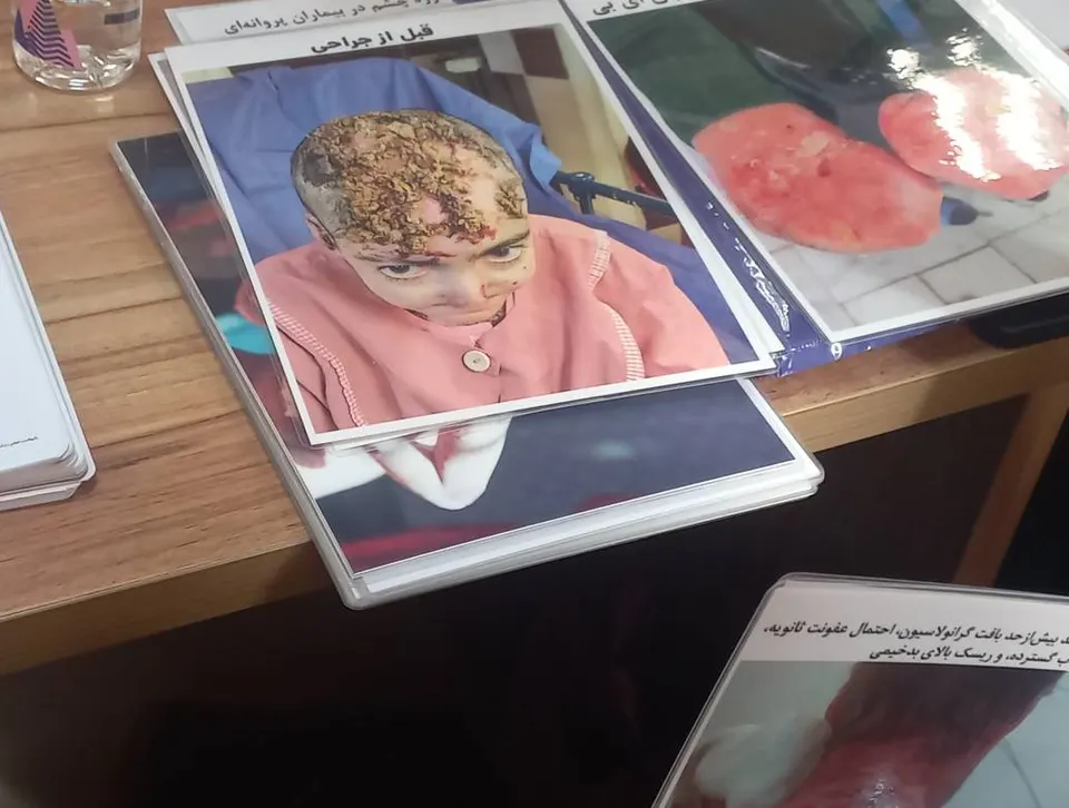 مستندسازی آثار تحریم‌ها بر بیماران خاص در ستاد حقوق بشر